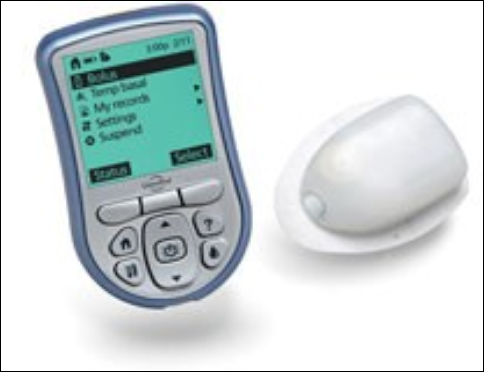 Omnipod First Generation